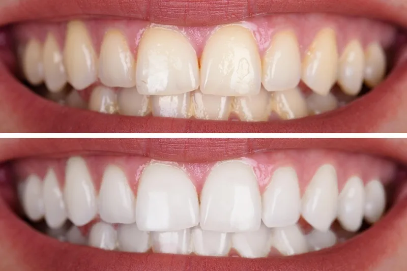 Rehabilitación oral